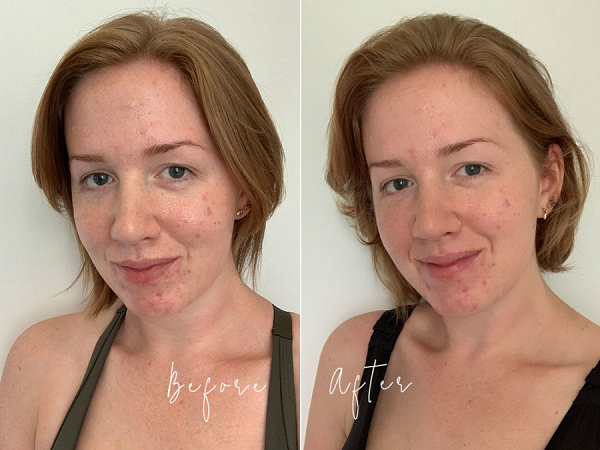 Trial Tribe reviews: Clear Skin Blemish Control Mask