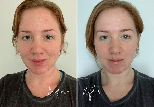 Trial Tribe reviews: Clear Skin Tonic