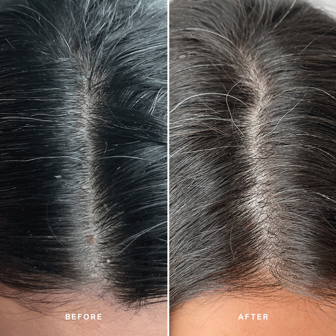 1080-BeforeAfter.gif
