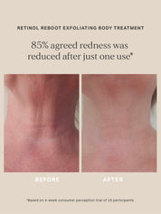 Retinol Reboot Exfoliating Body Treatment