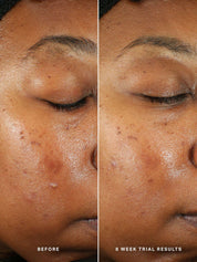 Generation Glow Daily Resurfacing Essence 30ml